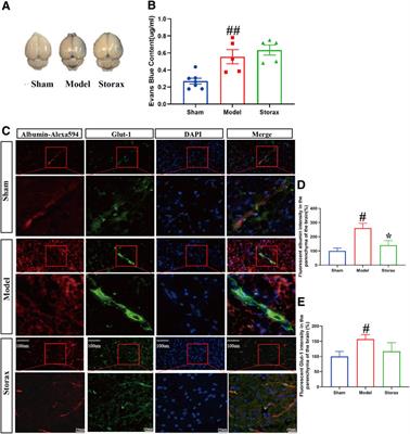 Storax Inhibits Caveolae-Mediated Transcytosis at Blood-Brain Barrier After Ischemic Stroke in Rats